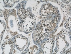 ZDHHC9 Rabbit anti-Human, Mouse, Polyclonal, Proteintech 150 &mu;L; Unconjugated:Antibodies,