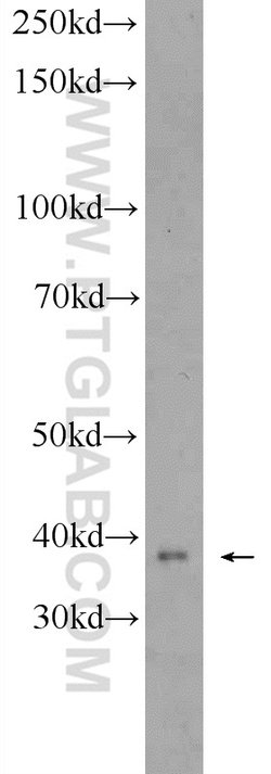 ZDHHC9 Rabbit anti-Human, Mouse, Polyclonal, Proteintech 150 &mu;L; Unconjugated:Antibodies,
