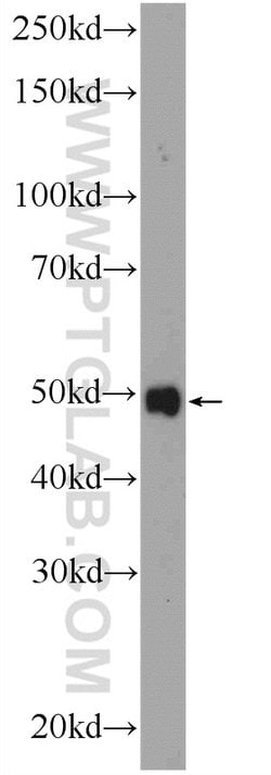 ZDHHC9 Rabbit anti-Human, Mouse, Polyclonal, Proteintech 150 &mu;L; Unconjugated:Antibodies,