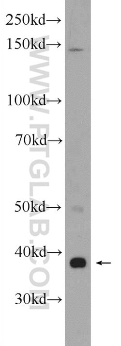 ZDHHC9 Rabbit anti-Human, Mouse, Polyclonal, Proteintech 150 &mu;L; Unconjugated:Antibodies,