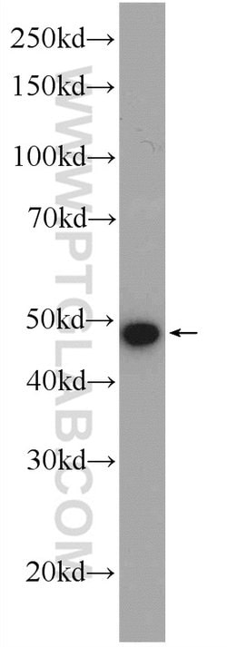 ZDHHC9 Rabbit anti-Human, Mouse, Polyclonal, Proteintech 150 &mu;L; Unconjugated:Antibodies,