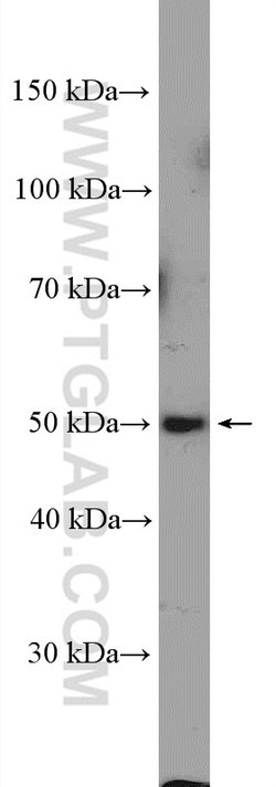 ZDHHC9 Rabbit anti-Human, Mouse, Polyclonal, Proteintech 150 &mu;L; Unconjugated:Antibodies,