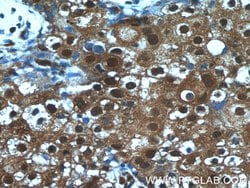 ANKS3 Rabbit anti-Human, Mouse, Polyclonal, Proteintech 150 &mu;L; Unconjugated:Antibodies,