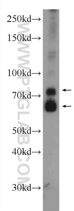 ANKS3 Rabbit anti-Human, Mouse, Polyclonal, Proteintech 150 &mu;L; Unconjugated:Antibodies,