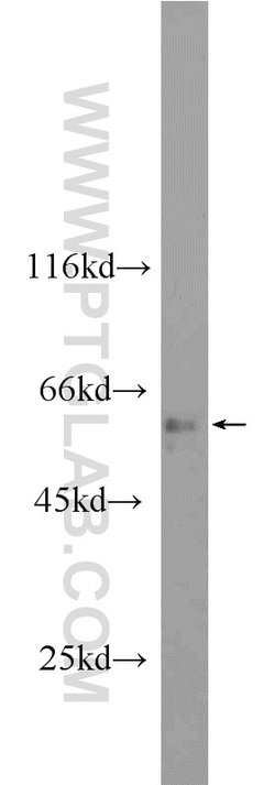 ANKS3 Rabbit anti-Human, Mouse, Polyclonal, Proteintech 150 &mu;L; Unconjugated:Antibodies,