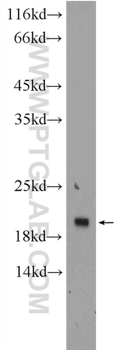 TMEM27 Rabbit anti-Human, Polyclonal, Proteintech 150 &mu;L; Unconjugated:Antibodies,