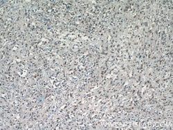 SGF29 Rabbit anti-Human, Polyclonal, Proteintech 20 &mu;L; Unconjugated:Antibodies,