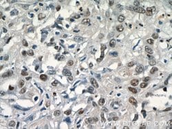SGF29 Rabbit anti-Human, Polyclonal, Proteintech 20 &mu;L; Unconjugated:Antibodies,