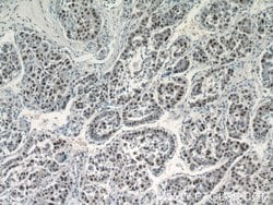 SGF29 Rabbit anti-Human, Polyclonal, Proteintech 20 &mu;L; Unconjugated:Antibodies,