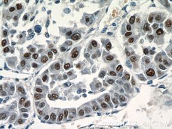 SGF29 Rabbit anti-Human, Polyclonal, Proteintech 20 &mu;L; Unconjugated:Antibodies,