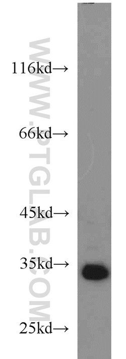 SGF29 Rabbit anti-Human, Polyclonal, Proteintech 20 &mu;L; Unconjugated:Antibodies,