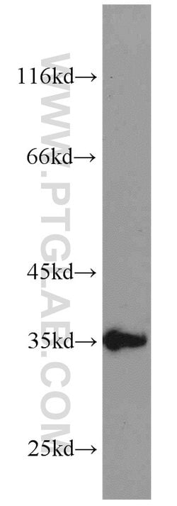 SGF29 Rabbit anti-Human, Polyclonal, Proteintech 20 &mu;L; Unconjugated:Antibodies,