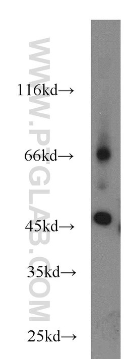 SLC36A4 Rabbit anti-Human, Polyclonal, Proteintech 150 &mu;L; Unconjugated:Antibodies,