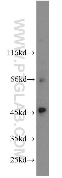 SLC36A4 Rabbit anti-Human, Polyclonal, Proteintech 150 &mu;L; Unconjugated:Antibodies,