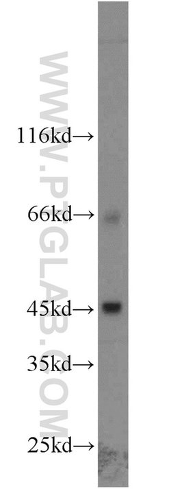 SLC36A4 Rabbit anti-Human, Polyclonal, Proteintech 150 &mu;L; Unconjugated:Antibodies,