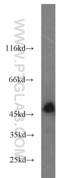SPRED2 Rabbit anti-Human, Mouse, Rat, Polyclonal, Proteintech 150 &mu;L;