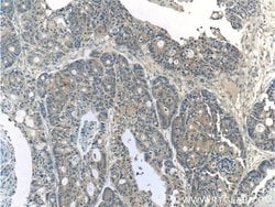 CYS1 Rabbit anti-Human, Polyclonal, Proteintech:Antibodies:Primary Antibodies