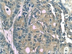 CYS1 Rabbit anti-Human, Polyclonal, Proteintech:Antibodies:Primary Antibodies