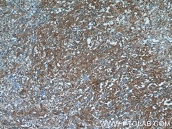 ATF6 Rabbit anti-Human, Mouse, Rat, Polyclonal, Proteintech:Antibodies:Primary