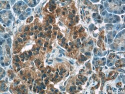 ATF6 Rabbit anti-Human, Mouse, Rat, Polyclonal, Proteintech:Antibodies:Primary