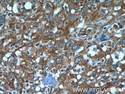 ATF6 Rabbit anti-Human, Mouse, Rat, Polyclonal, Proteintech:Antibodies:Primary