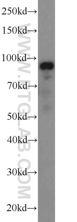 ATF6 Rabbit anti-Human, Mouse, Rat, Polyclonal, Proteintech:Antibodies:Primary