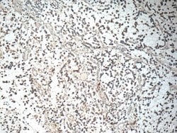 IL-1F6 / IL-36 alpha Rabbit anti-Human, Polyclonal, Proteintech 20 &mu;L;