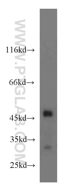 GSK3B Rabbit anti-Human, Mouse, Polyclonal, Proteintech 20 &mu;L; Unconjugated:Antibodies,