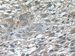 ROMO1 Rabbit anti-Human, Polyclonal, Proteintech:Antibodies:Primary Antibodies