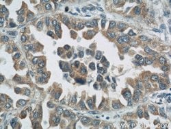 ROMO1 Rabbit anti-Human, Polyclonal, Proteintech:Antibodies:Primary Antibodies