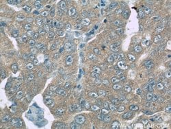 ROMO1 Rabbit anti-Human, Polyclonal, Proteintech:Antibodies:Primary Antibodies