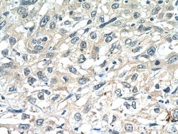 ANKRD55 Rabbit anti-Human, Polyclonal, Proteintech 150 &mu;L; Unconjugated:Antibodies,