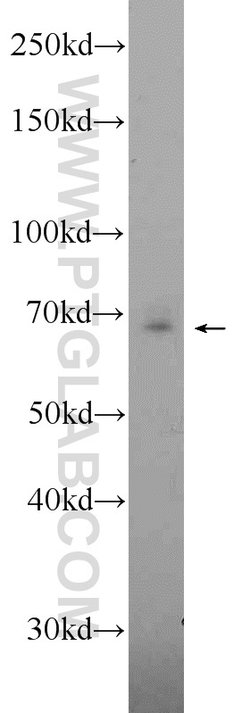 ANKRD55 Rabbit anti-Human, Polyclonal, Proteintech 150 &mu;L; Unconjugated:Antibodies,