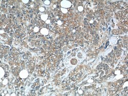 C7orf47 Rabbit anti-Human, Polyclonal, Proteintech:Antibodies:Primary Antibodies