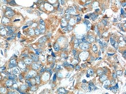 C7orf47 Rabbit anti-Human, Polyclonal, Proteintech:Antibodies:Primary Antibodies