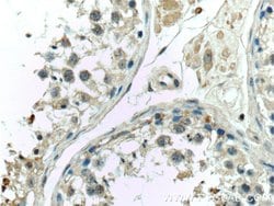 C7orf47 Rabbit anti-Human, Polyclonal, Proteintech:Antibodies:Primary Antibodies