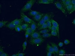 C7orf47 Rabbit anti-Human, Polyclonal, Proteintech:Antibodies:Primary Antibodies
