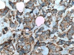C7orf47 Rabbit anti-Human, Polyclonal, Proteintech:Antibodies:Primary Antibodies
