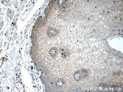 GJB6 Rabbit anti-Human, Polyclonal, Proteintech 150 &mu;L; Unconjugated:Antibodies,
