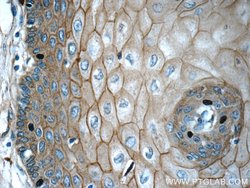 GJB6 Rabbit anti-Human, Polyclonal, Proteintech 150 &mu;L; Unconjugated:Antibodies,