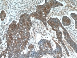 GJB6 Rabbit anti-Human, Polyclonal, Proteintech 150 &mu;L; Unconjugated:Antibodies,