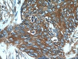 GJB6 Rabbit anti-Human, Polyclonal, Proteintech 150 &mu;L; Unconjugated:Antibodies,