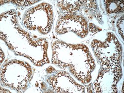 ANKRD53 Rabbit anti-Human, Polyclonal, Proteintech 150 &mu;L; Unconjugated:Antibodies,