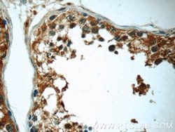 ANKRD53 Rabbit anti-Human, Polyclonal, Proteintech 150 &mu;L; Unconjugated:Antibodies,