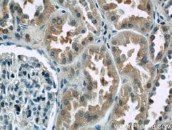 ANKRD53 Rabbit anti-Human, Polyclonal, Proteintech 150 &mu;L; Unconjugated:Antibodies,