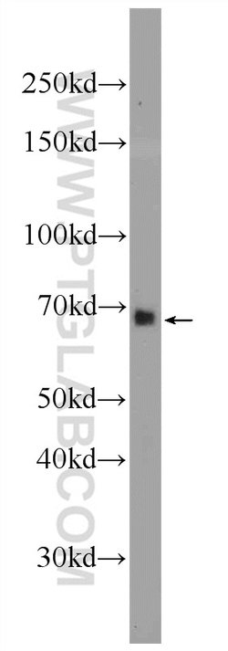 ANKRD53 Rabbit anti-Human, Polyclonal, Proteintech 150 &mu;L; Unconjugated:Antibodies,