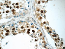 PAPOLG Rabbit anti-Human, Polyclonal, Proteintech:Antibodies:Primary Antibodies