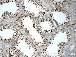 PAPOLG Rabbit anti-Human, Polyclonal, Proteintech:Antibodies:Primary Antibodies