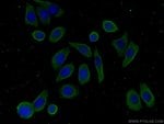 Thumbnail_FAM71F2 Rabbit anti-Human, Mouse, Polyclonal, Proteintech 150 &mu;L; Unconjugated:Antibodies,