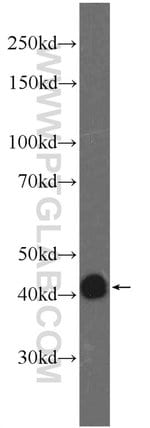 Thumbnail_FAM71F2 Rabbit anti-Human, Mouse, Polyclonal, Proteintech 150 &mu;L; Unconjugated:Antibodies,